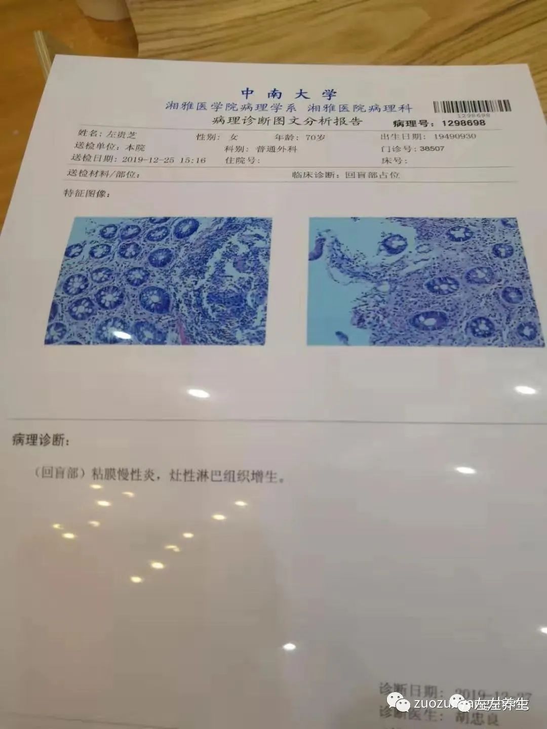 案例分享:70岁老人腹痛(医院初诊可能升结肠癌)飞蛾症、腿抽筋、失眠调理案例 案例分享:70岁老人腹痛(医院初诊可能升结肠癌)飞蛾症、腿抽筋、失眠调理案例